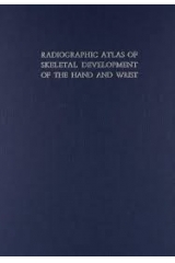 Radiographic Atlas of Skeletal Development of the Hand and Wrist